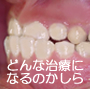 sample