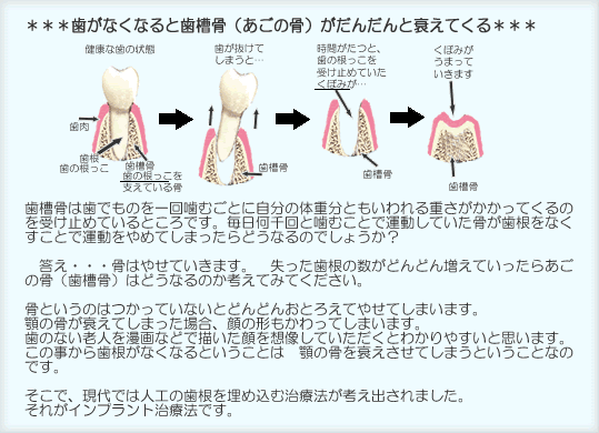 ȂȂƎi̍j񂾂ƐĂB͎ł̂񊚂ނƂɎ̑̏dƂdĂ̂󂯎~߂ĂƂłBƊނƂŉ^ĂȂƂŉ^߂Ă܂ǂȂ̂ł傤HEEE͂₹Ă܂B@̐ǂǂ񑝂Ă炠̍ij͂ǂȂ̂lĂ݂ĂBƂ̂͂ĂȂƂǂǂ񂨂Ƃ낦Ă₹Ă܂܂B{̍Ă܂ꍇǍ`Ă܂܂B̂ȂVl𖟉Ȃǂŕ`zĂƂ킩₷Ǝv܂B̎玕ȂȂƂƂ́@{̍𐊂Ă܂ƂƂȂ̂łBŁAł͐lH̎𖄂ߍގÖ@lo܂BꂪCvgÖ@łB