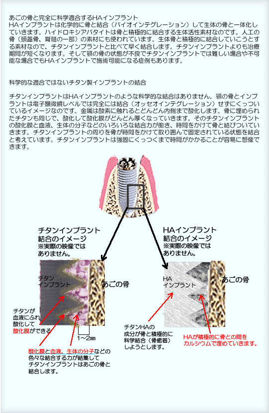 ̍ƊSɉȊwKHACvgBHACvg͉wIɍƌioCICeO[VjĐ̂̍ƈ̉Ă܂BnChLVAp^Cg͍ƐϋɓIɌ鐶̊fނȂ̂łBlH̍iWAҐ̈ꕔj̑fނɂgĂ܂B̍ƐϋɓIɌĂƂfނȂ̂ŁA`^CvgƔׂđ܂B`^CvgÊԂZȂ܂BĊ{̍̏ԂsǂŃ`^Cvgł͓ꍇs\ȏꍇłHACvgŎ{p\ɂȂǗ܂B@ȊwIȓKł͂Ȃ`^CvǧB`^CvgHACvĝ悤ȉȊwIȌ͂܂B{̍ƃCvg͓dqxł͊Sɂ͌iIbZICeO[VjɂĂC[WȂ̂łB͎_fɐGƂǂǂ܂Ŏ_܂Bɖ߂ꂽ`^ŁA_Ď_ǂǂȂĂ܂B̃`^Cvg̎_ƌtÂ̕qȂǂ̂낢Ȍ͂AԂčƌтĂ܂B`^Cvg̎ԂĎ͂ŌŒ肳ĂԂƍlĂ܂B`^Cvg͋łɂ܂ŎԂ邱ƂeՂɑzł܂B