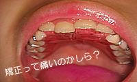 sample